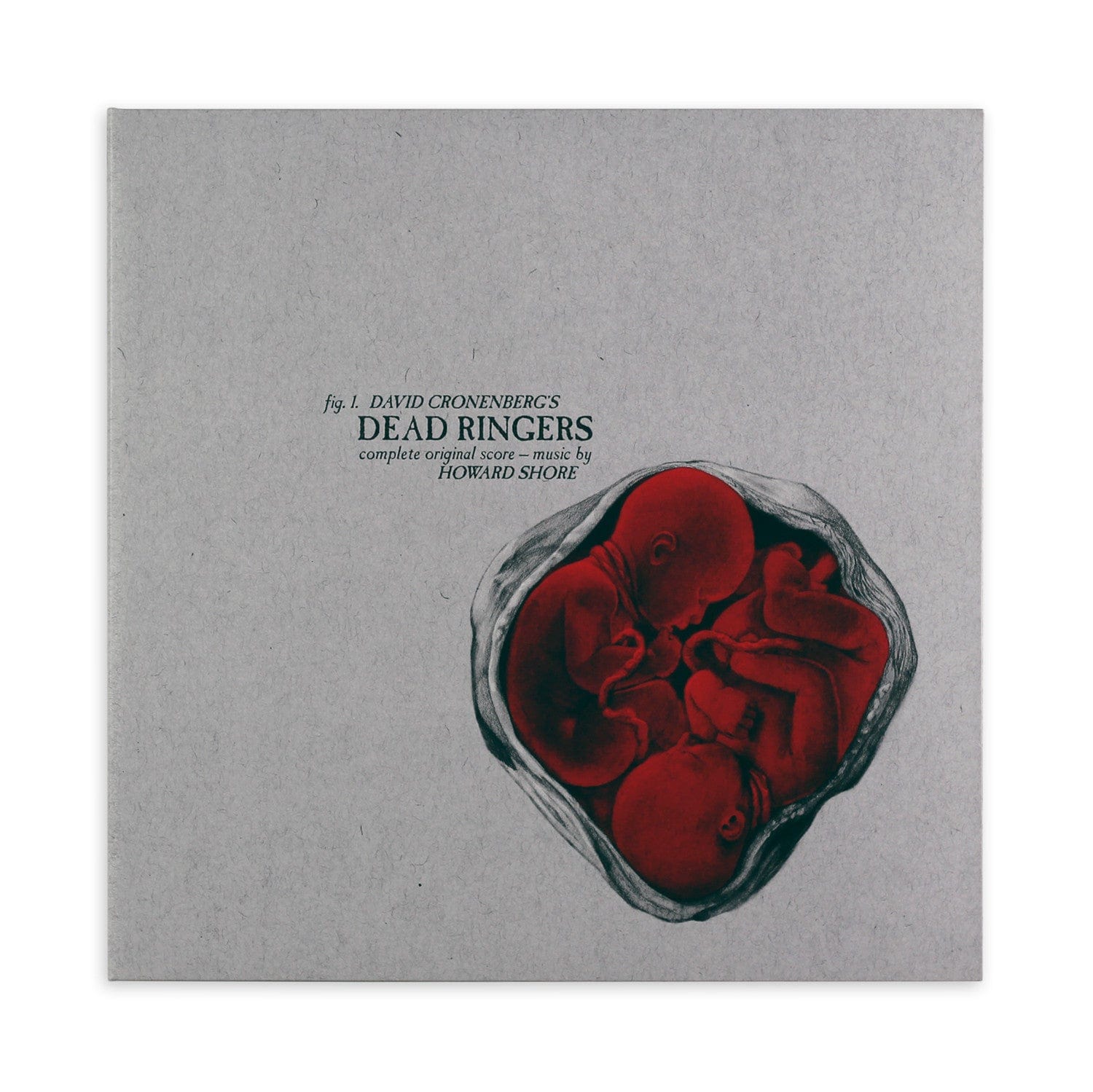 Dead Ringers – Original Motion Picture Soundtrack LP (Version B) – Mondo